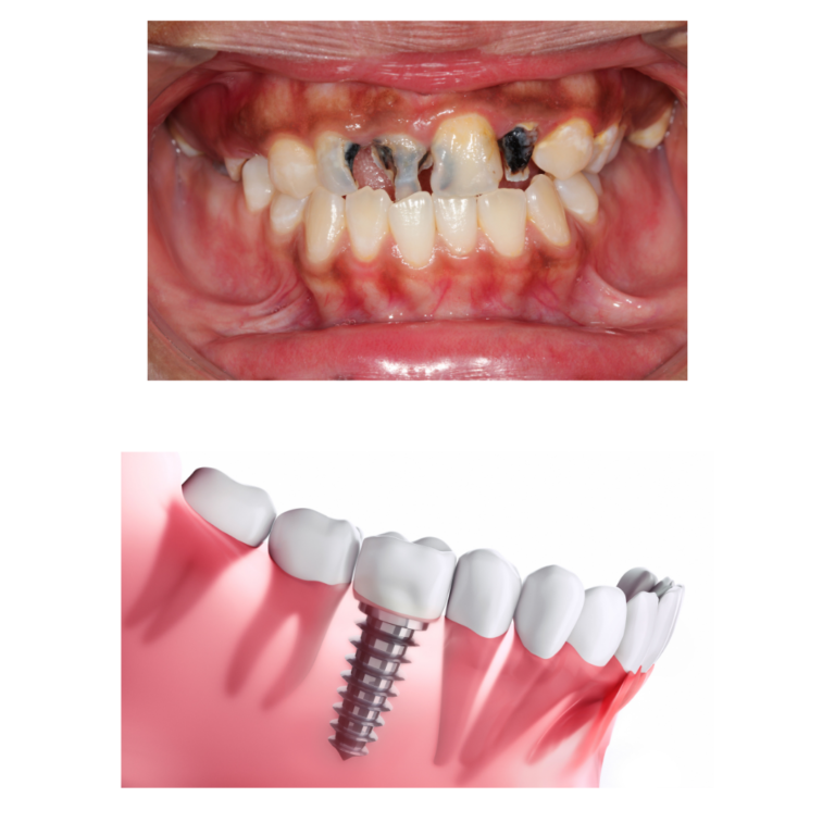 Addressing the Latest Dental Problems in the Middle East Region